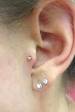 Neometal tragus